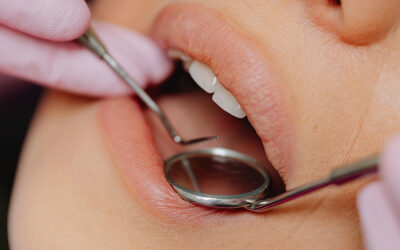 The Silent Shift — How Menopause Affects Your Oral Health