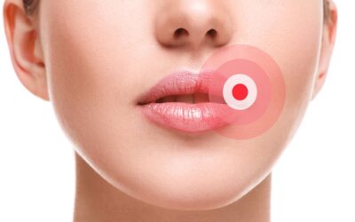 Why Routine Dental Visits Matter — and How Laser Therapy Can Ease Cold Sore Discomfort