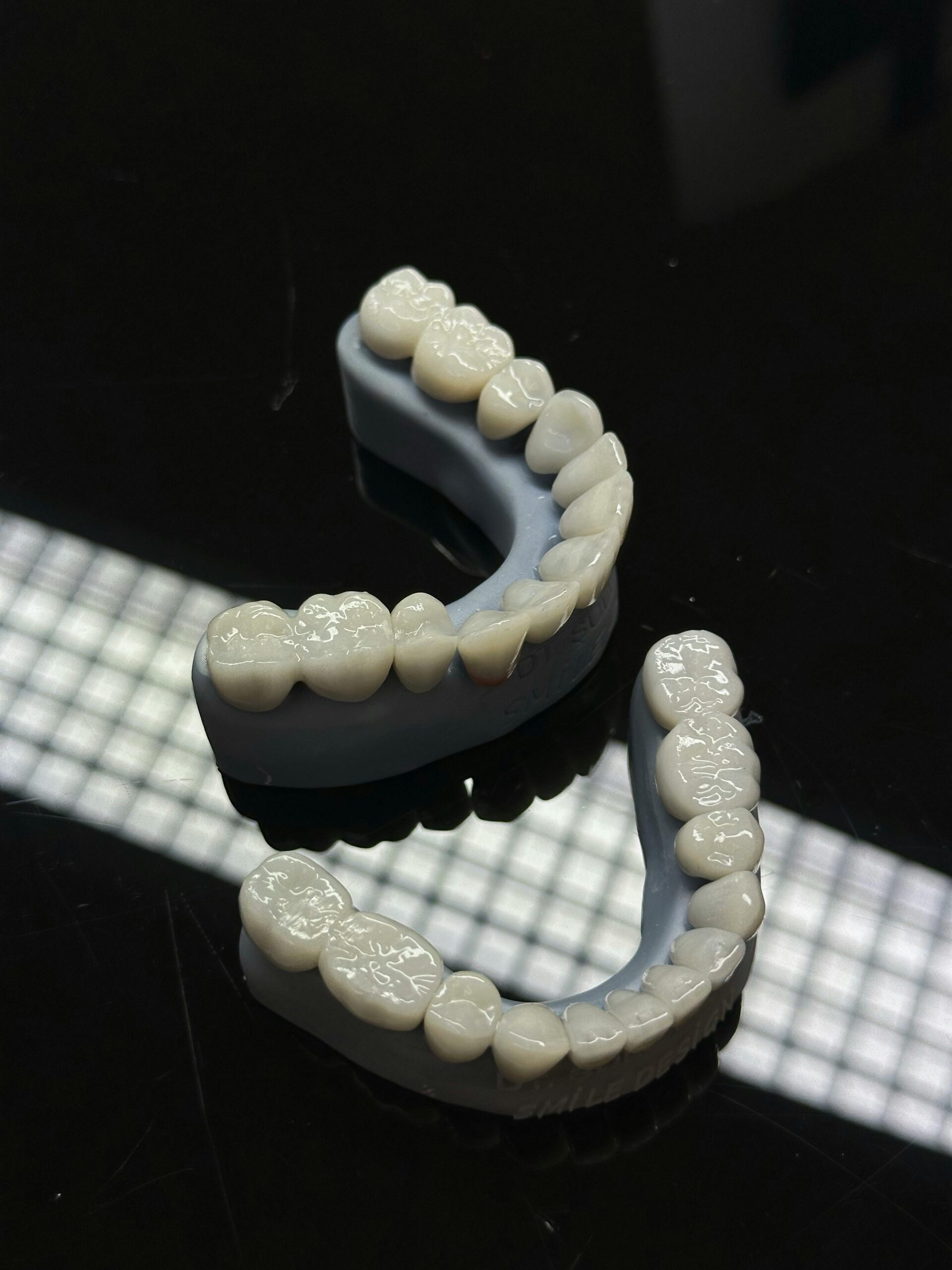 Tooth articles smile lab