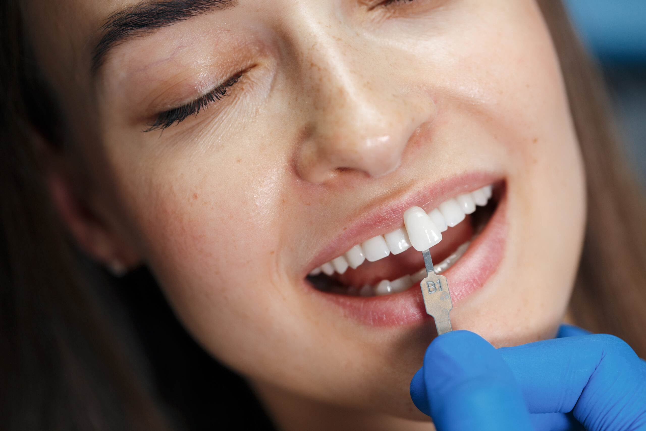 Treatment Smile Labs